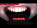 Contrastador 601 AUT - Fotodental