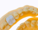 Resina 3D dental - Bio Crown - p/ hacer  Coronas Dentales - Biocompatible - 250gr Prizma