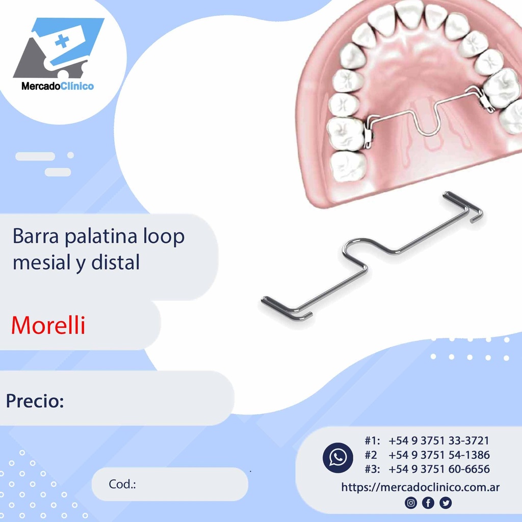 Barra palatina loop mesial y distal - Morelli