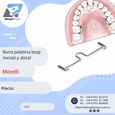 Barra palatina loop mesial y distal - Morelli